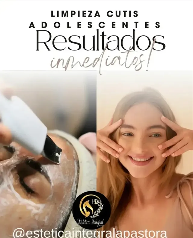 Limpiezas de cutis para dolecentes con o sin Cura de Acne