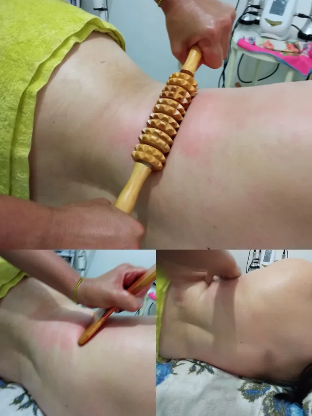 Tratamiento Reductor. Maderoterapia
