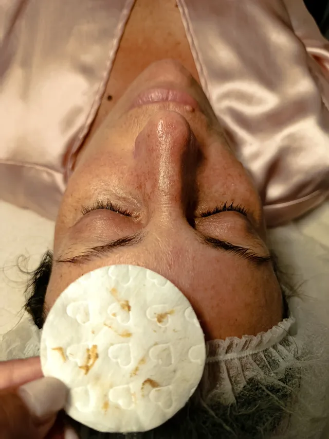Limpié Facial   impurezas