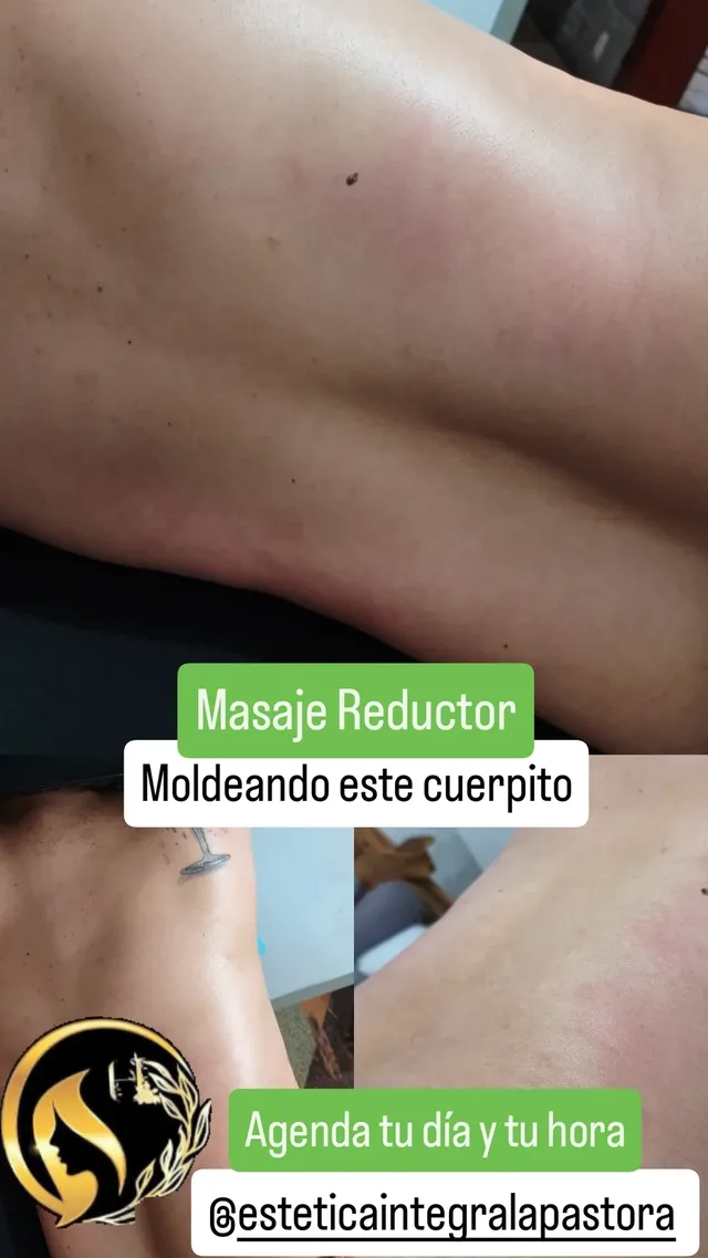 Nuestros Masajes Reductores viene incluído el Drenaje Linfatico y combinado con maderoterapia y aparatologia son todo un éxito