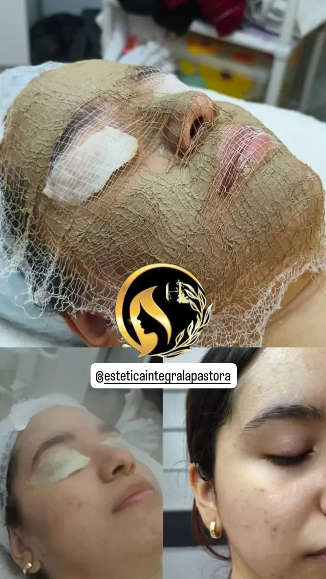 Limpiezas de cutis y tratamientos para piel Madura