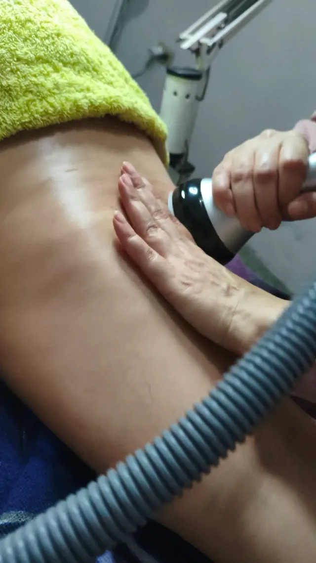 Tratamiento Reductor y levantamiento de Glúteos . Vacumterapia
