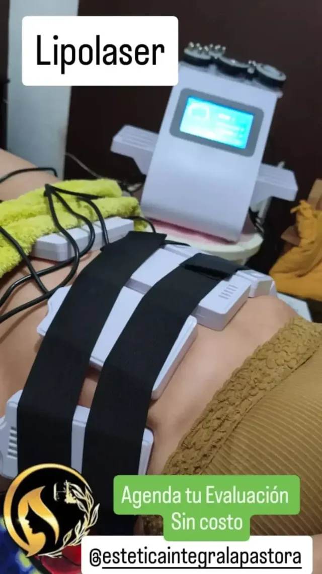 Tratamiento Reductor Lipolaser