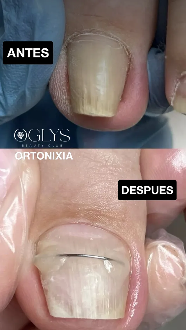 ORTONIXIA